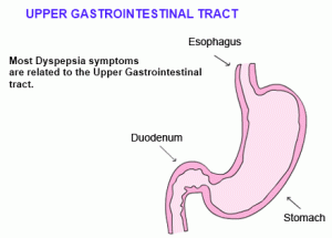 dyspepsia